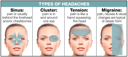 Types of headaches