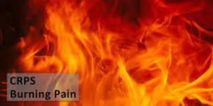 CRPS burning pain